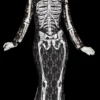 "Lacy Bones" Costume (Adult Size)